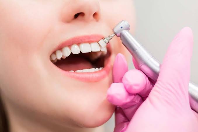Limpieza dental Profunda
